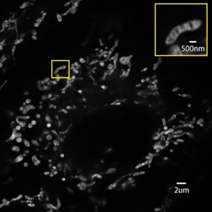 Real time live cell imaging of mitochondria (10FPS)